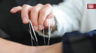 Instituto Confucio Santo Tomás realizará webinar sobre acupuntura y su integración en Chile